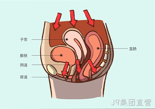 助力女性盆底功能健康发展，J9集团直营推出高频评估电灼仪